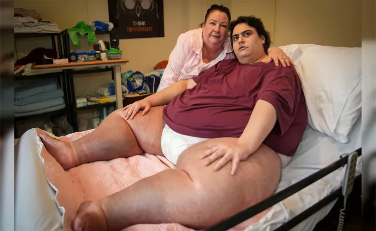 Britains Heaviest Man dying From Organ Failure Before 34th Birth Day