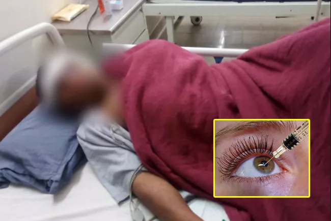 Mob injects acid in man's eyes for allegedly eloping with his employer's wife - Sakshi
