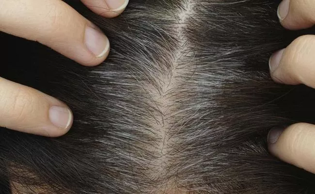 Tips And Remedies For Get Free From Gray Hair Problem - Sakshi
