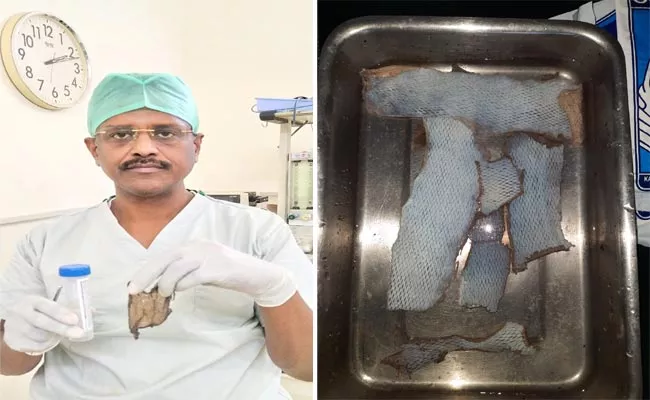 Doctors Made Plastic Surgery Successful By Transplanting Skin In Guntur - Sakshi