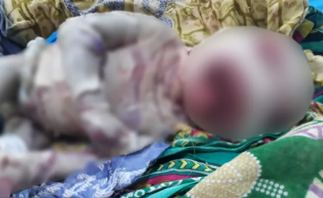 A Baby Born With Genetic Defects In Odisha - Sakshi