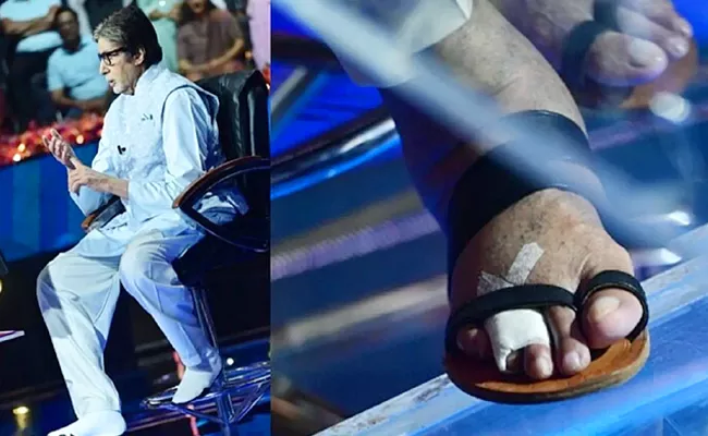 Amitabh Bachchan Shares Fractured Toe Pics - Sakshi