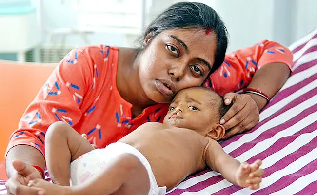Born With A Cleft Lip and Failing Liver My Son Needs A Transplant To Live - Sakshi