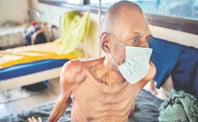 TB patients at higher mortality risk even after treatment - Sakshi