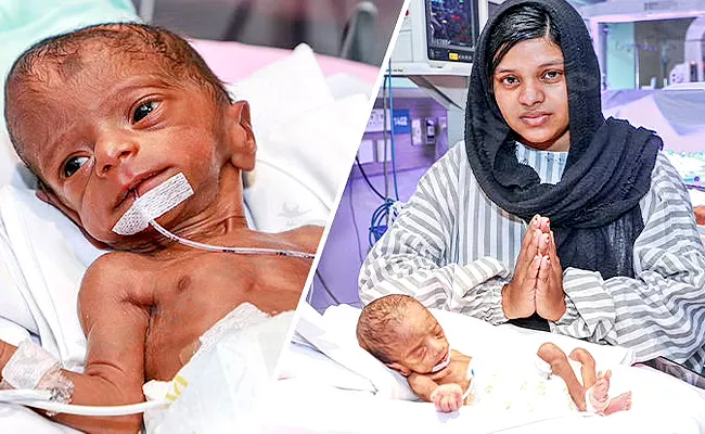 Save Fathima Premature Twins who Fought Hard To Become A Mother - Sakshi