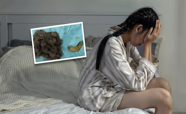 14 Year Old China Teenager Had Strange Habit Ate 3 Kg Of Her Own Hair  - Sakshi