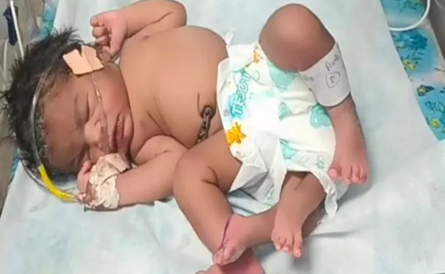 Baby Born With Four Legs Madhya Pradesh Gwalior Pic Surfaces - Sakshi
