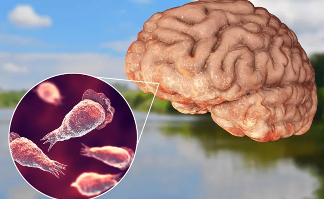 Brain Eating Amoeba Kills South Korean Man Naegleria Fowleri - Sakshi