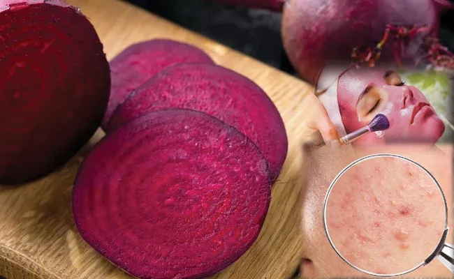 Beauty Tips: Prevention of Pimples And Scars With Beetroot - Sakshi