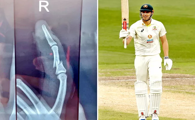 X-ray Reveals Cameron Green Batted For Four Hours With Broken Finger - Sakshi