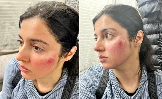 Bollywood Actress Divya Khosla Kumar badly injured on sets - Sakshi