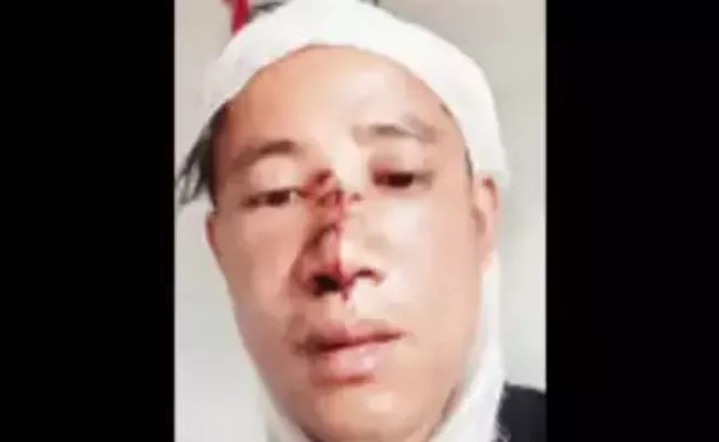 Sikkim Man Called Chinese and Brutally Thrashed in Bengaluru - Sakshi