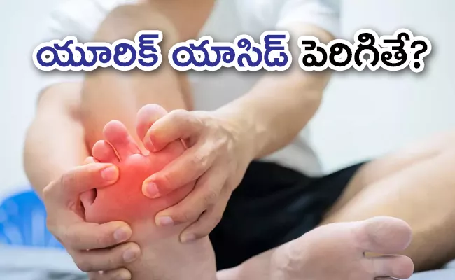 How To Lower Uric Acid Levels Naturally - Sakshi