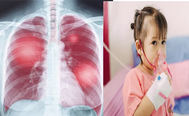 Mysterious Pneumonia Outbrea Similar To China White Lung Syndrome - Sakshi