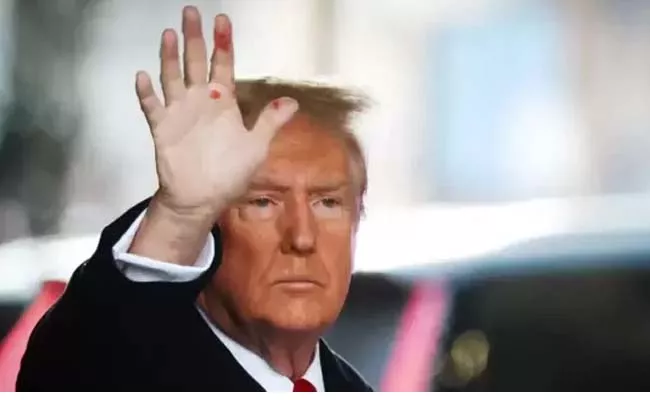 Donald Trump Hand With Red spots Photo Goes Viral - Sakshi