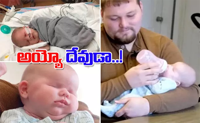 Baby Born Without Eyes Due to An Extremely Rare Genetic Disorder - Sakshi