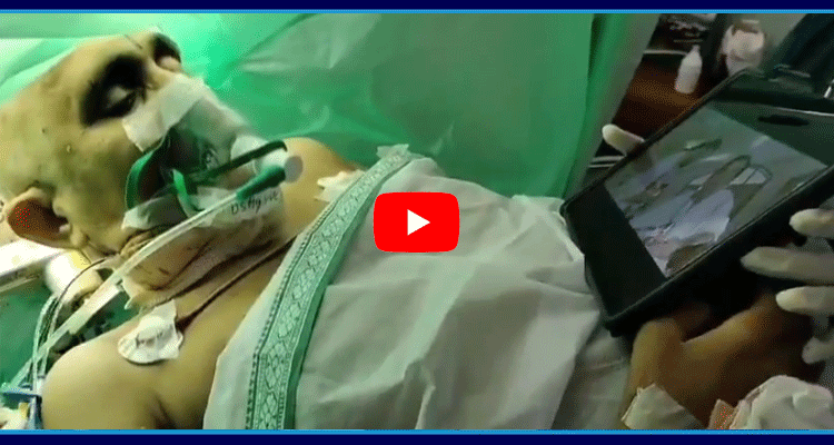 Patient Watching Brahmanandam Comedy Videos During The Surgery  1