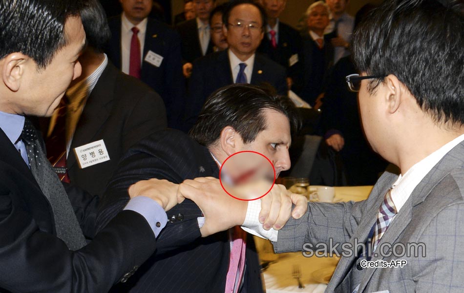 South Korea US envoy Lippert well after knife attack1