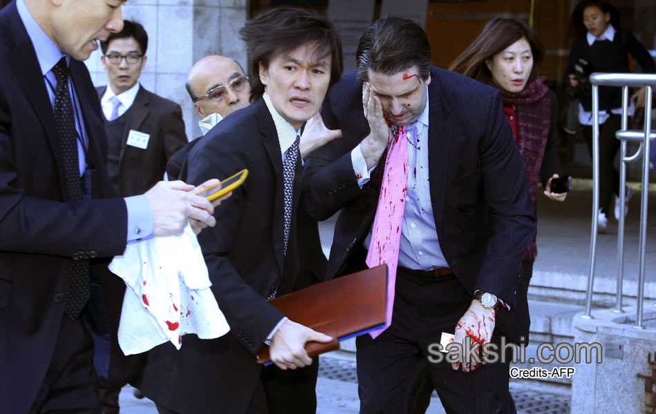 South Korea US envoy Lippert well after knife attack6