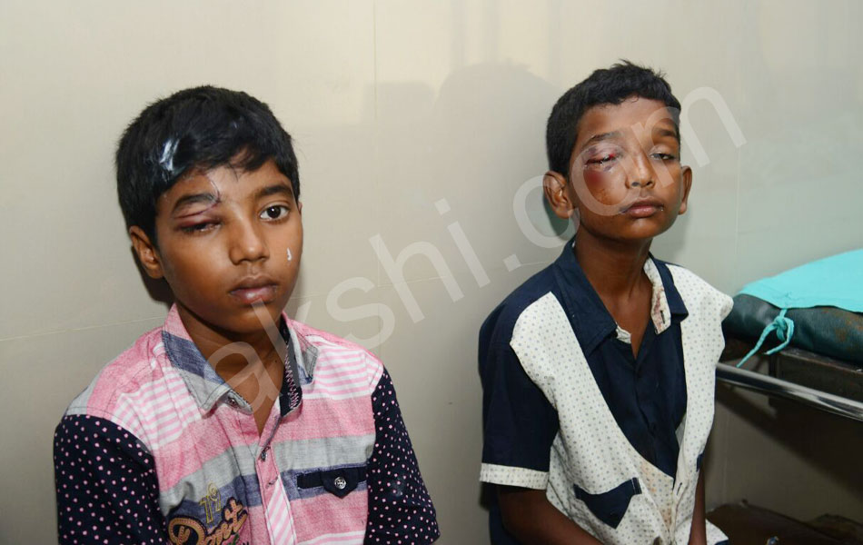 Diwali Eye Accidents in Hyderabad - Sakshi1