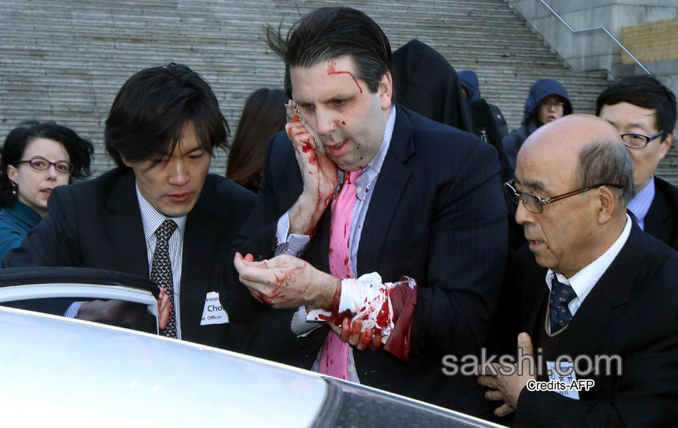 South Korea US envoy Lippert well after knife attack9