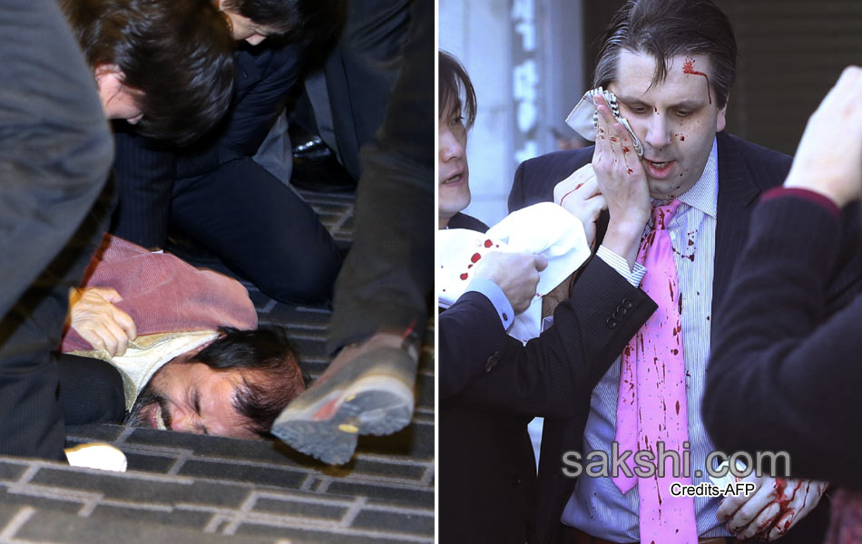 South Korea US envoy Lippert well after knife attack16