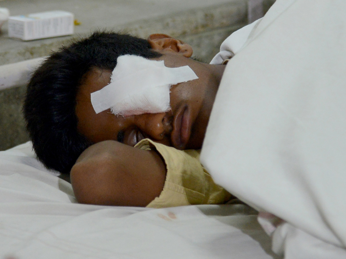 Suffered With Eye Injuries On Diwali Celebrations Photo Gallery - Sakshi9