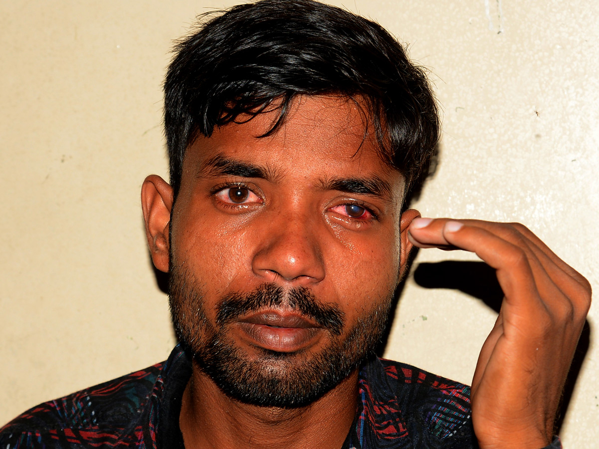 Suffered With Eye Injuries On Diwali Celebrations Photo Gallery - Sakshi10