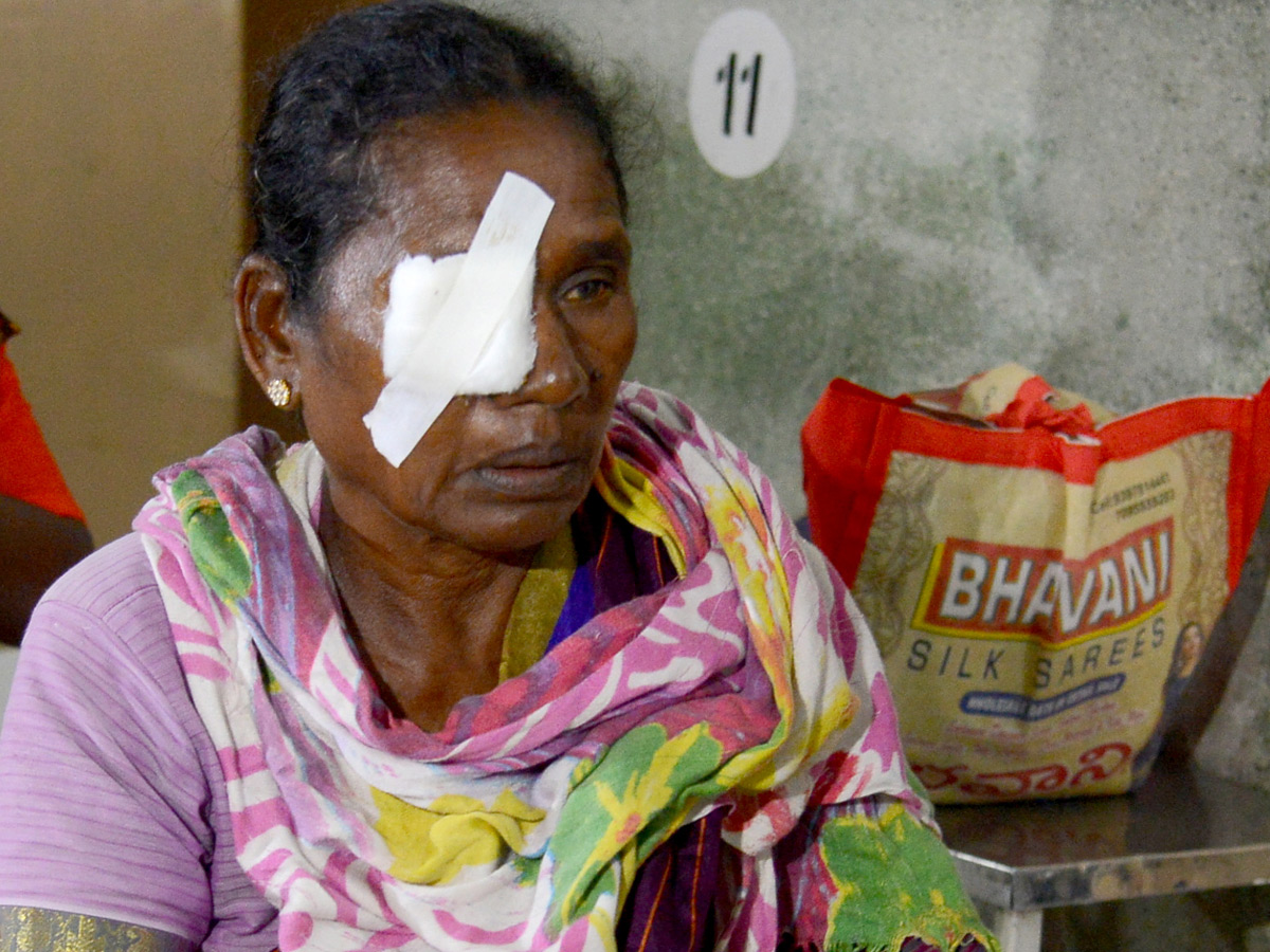 Suffered With Eye Injuries On Diwali Celebrations Photo Gallery - Sakshi3