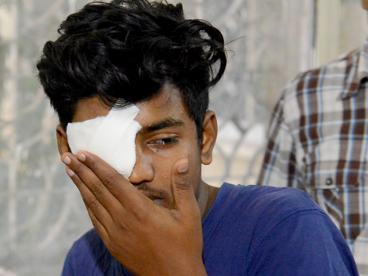 Suffered With Eye Injuries On Diwali Celebrations Photo Gallery - Sakshi8