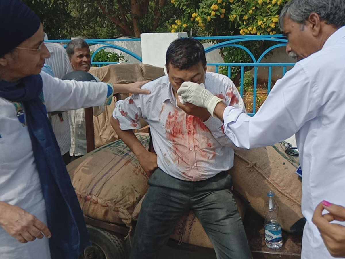 MMTS Train Collision Kachiguda Station Hyderabad Photo Gallery - Sakshi9