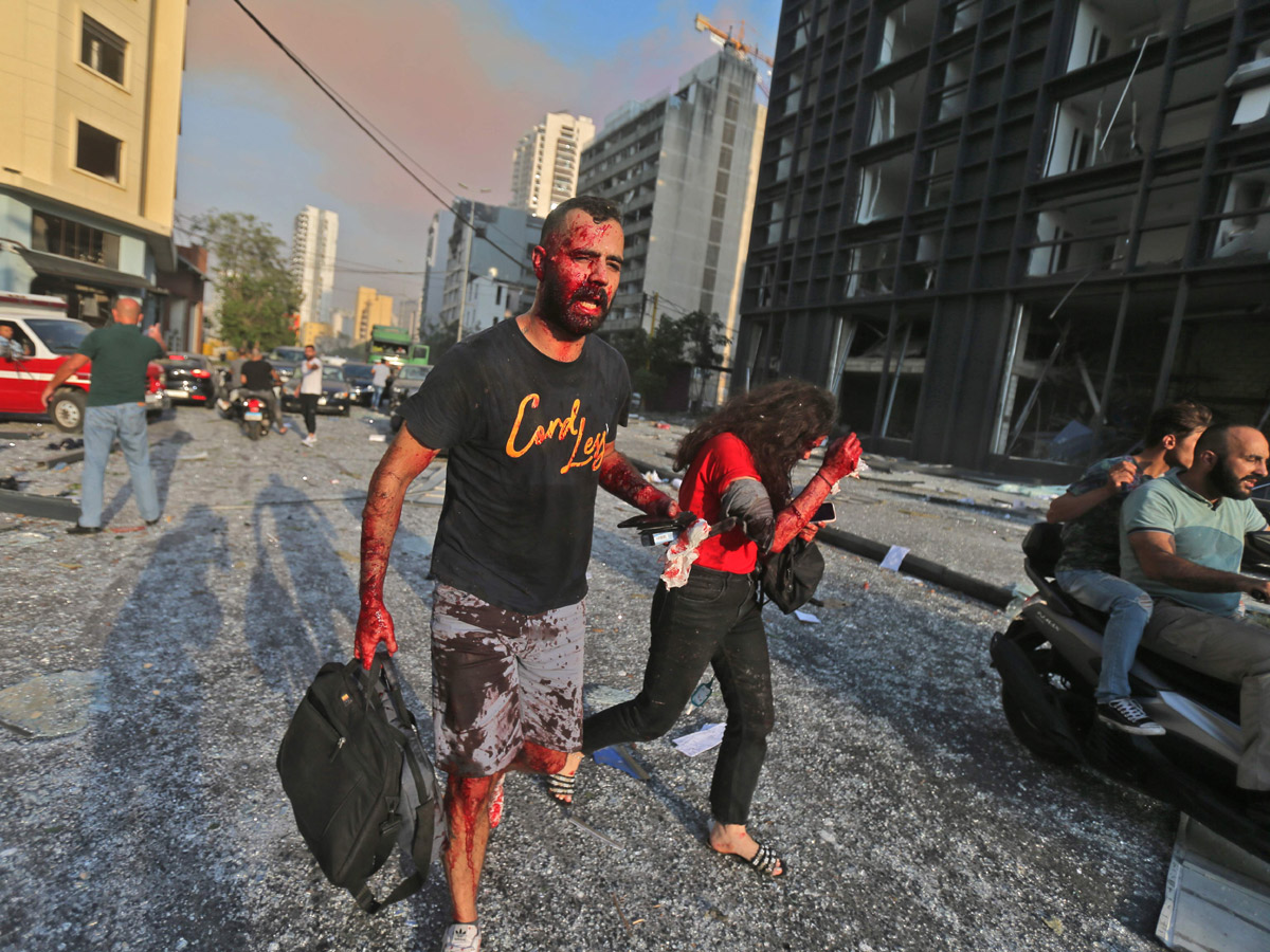 explosion at the port of Lebanons capital Beirut photo gallery - Sakshi17