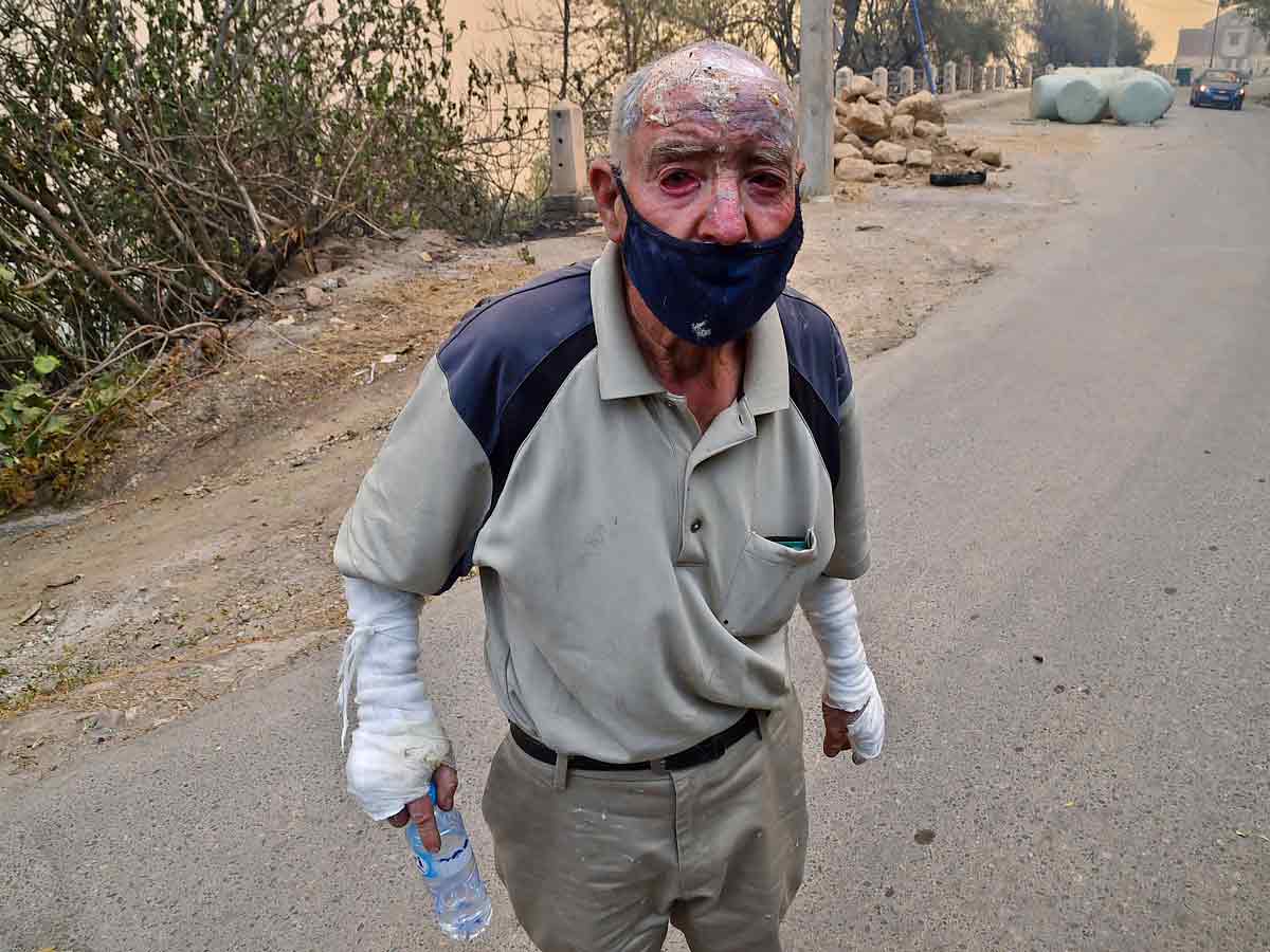 Algeria Wildfires Kill 42 Authorities Blame Arson Photo Gallery - Sakshi6