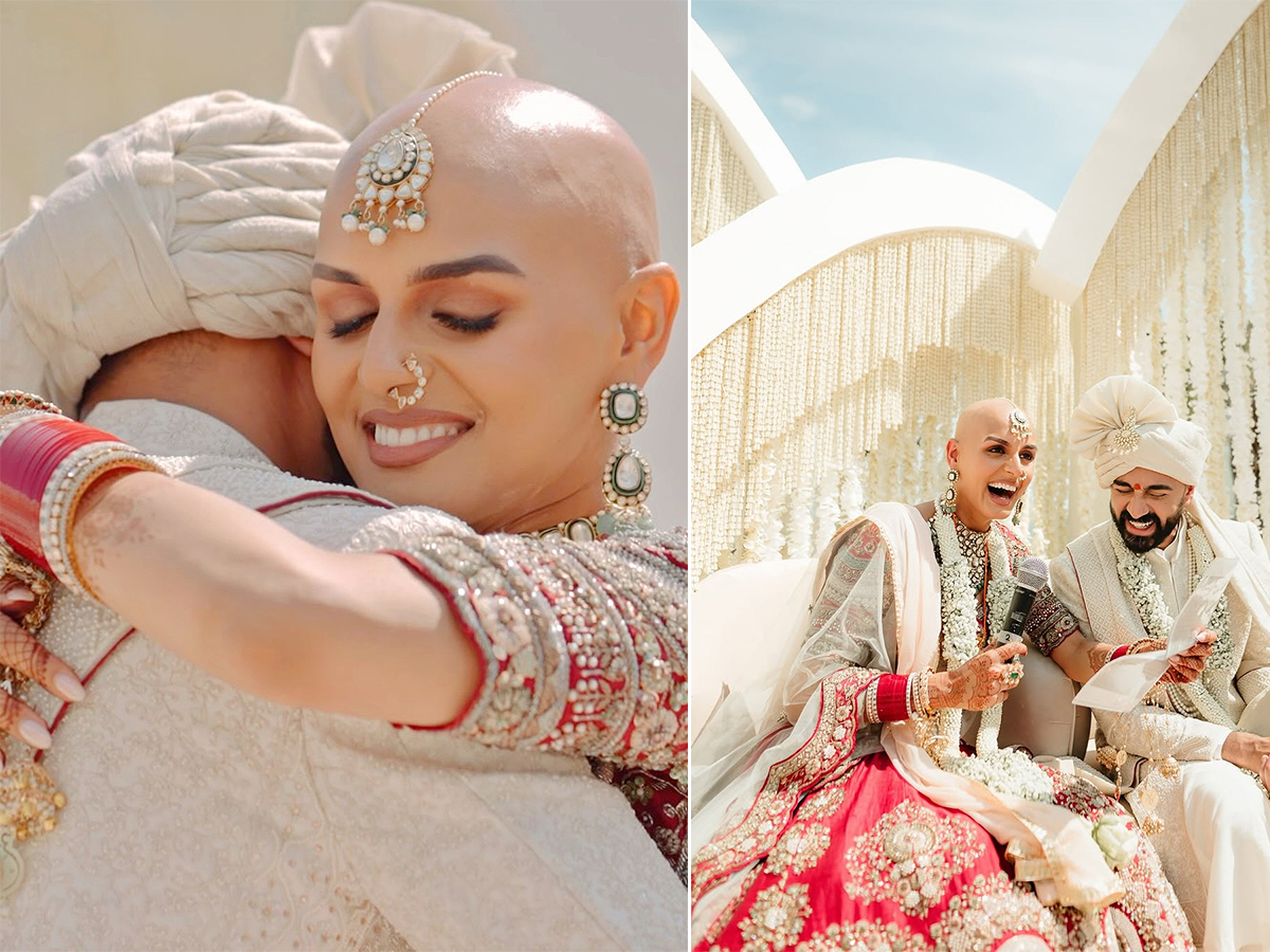 Bald and Beautiful: Indian Bride Ditches Wig, Flaunts Alopecia on Wedding Day1