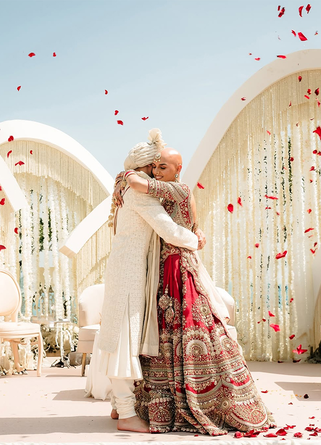 Bald and Beautiful: Indian Bride Ditches Wig, Flaunts Alopecia on Wedding Day11