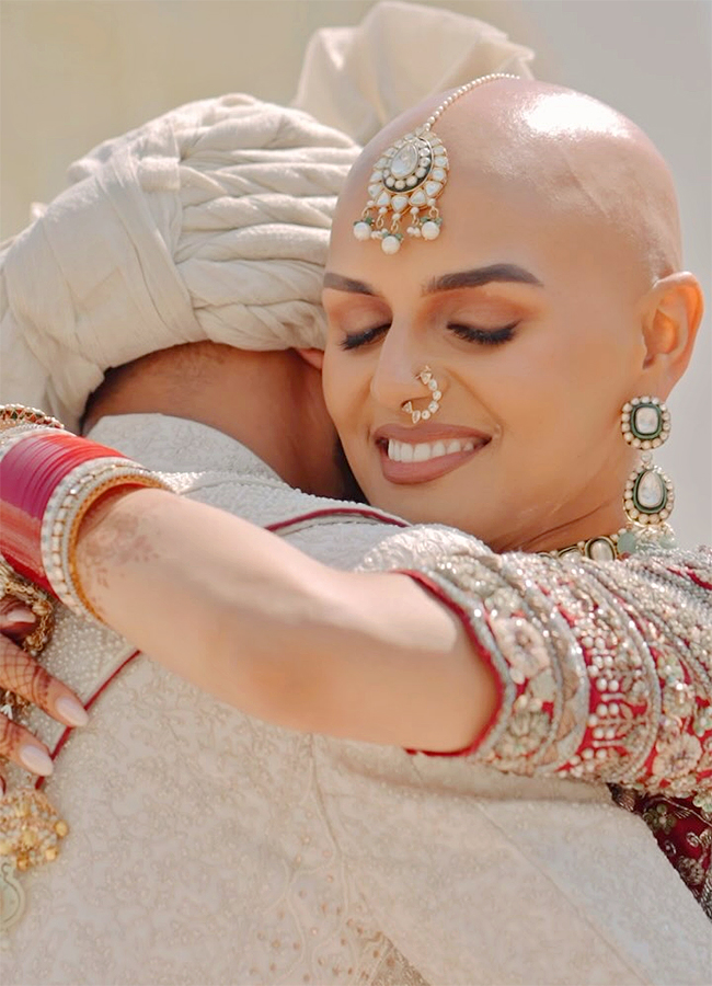 Bald and Beautiful: Indian Bride Ditches Wig, Flaunts Alopecia on Wedding Day15