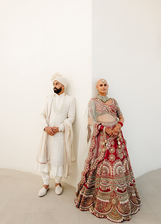 Bald and Beautiful: Indian Bride Ditches Wig, Flaunts Alopecia on Wedding Day2