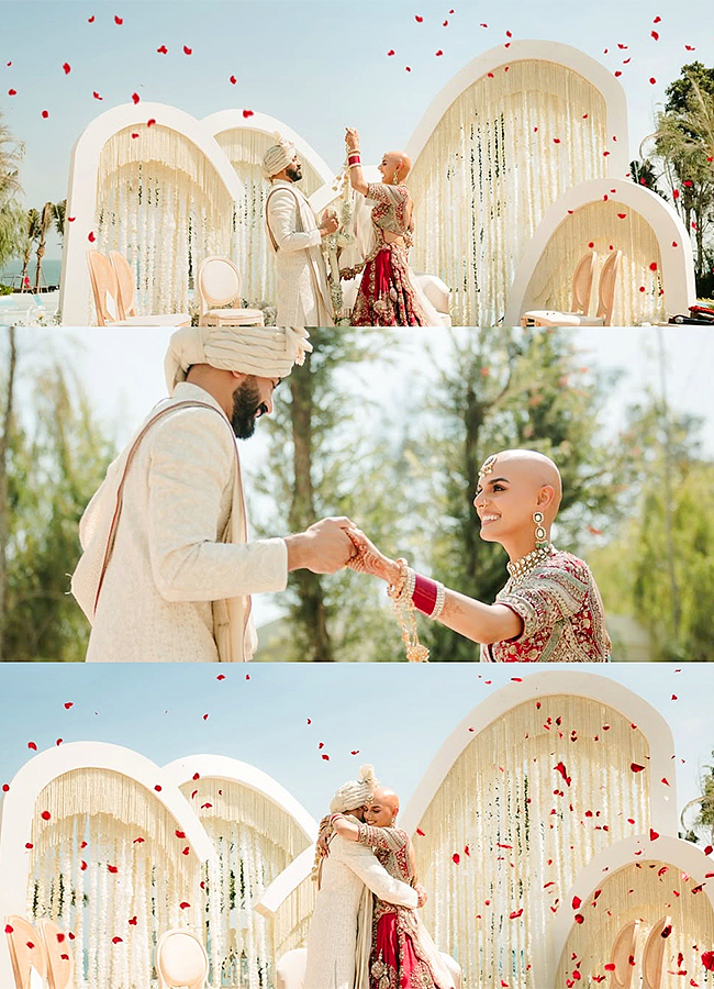 Bald and Beautiful: Indian Bride Ditches Wig, Flaunts Alopecia on Wedding Day6