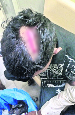 పెళ్లి ఊరేగింపులో అపశుృతి 1