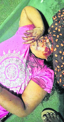 అదుపుతప్పి గుడ్లలారీ బోల్తా 3