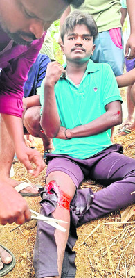 ఆటో ఢీకొని యువకుడికి గాయాలు1