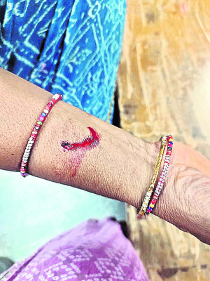 లక్ష్మీపురం డీలర్పై కూటమి నాయకుల దాడి
2