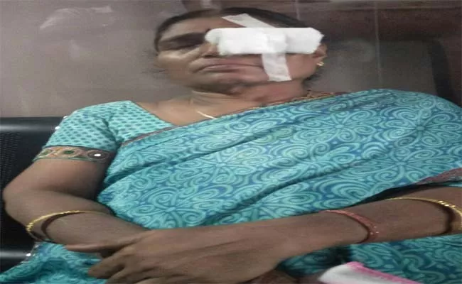 Doctor Negligence In Kanti Velugu Scheme Warangal - Sakshi