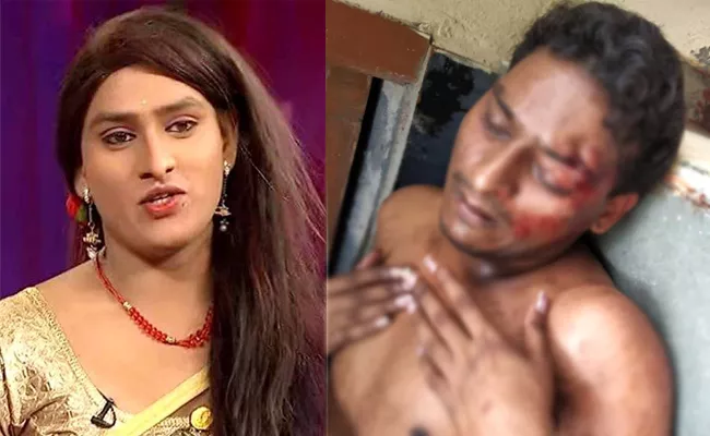 jabardasth Artist Vinod Attacked in kachiguda - Sakshi