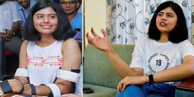 Shreya Siddanagowda Transplanted Man Hands Changed Colour - Sakshi