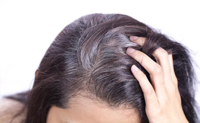 Columbia University Elife Journal Said Grey Hair Become Black If You Control Stress - Sakshi