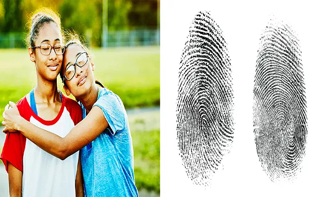 Do you know that identical twins fingerprints may have change - Sakshi