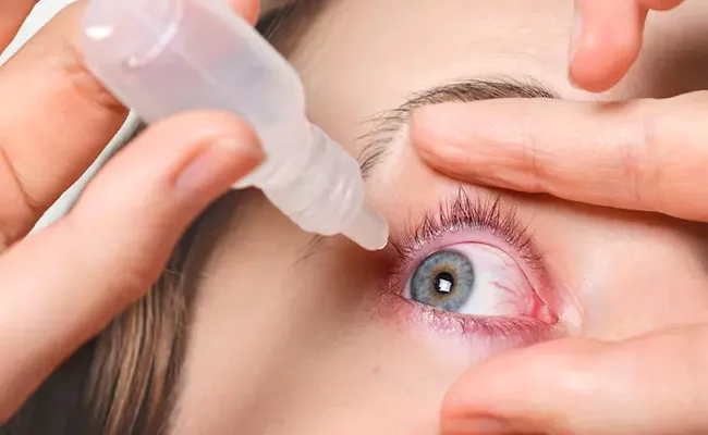 Dry Eye Irritation Try These Home Remedies To Prevent Dry Eyes In Natural Ways - Sakshi