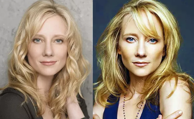 Actress Anne Heche In Coma After Car Crash - Sakshi
