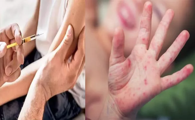Mumbai Reports 32 Fresh Cases Of Measles On Saturday - Sakshi